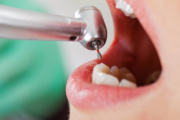 Best Emergency Dentist for Knocked-Out Tooth in Potomac Mills, VA